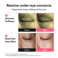 Abib Non-Slip Hydrogel Embossed Eye Patch stays in place during activities