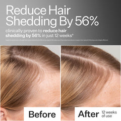 ACT+ ACRE serum pipette dispenses evenly for easy daily scalp application.