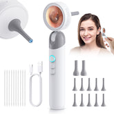 Aertnelz otoscope 1080p camera provides crystal-clear ear visualization for home care