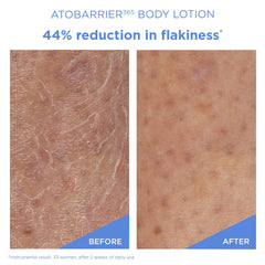 Close-up of AESTURA ATOBARRIER365 ceramide capsules highlighting barrier-support formula.