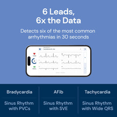 AliveCor KardiaMobile 6L Max compact size shown for pocket-ready monitoring.