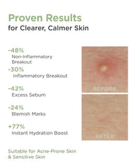 AROCELL Cica Hydrogel Mask micro-airhole technology enhances absorption.
