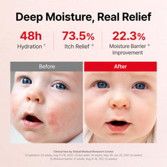 ATOPALM MLE eczema cream on forearm demonstrates long-lasting moisture for dry skin.
