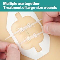 AZEN wound closure kit packaging highlights hygiene and individual packing