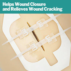 AZEN zip stitch application demonstrates simple wound closure in minutes