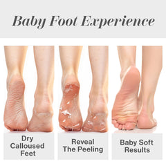 Baby Foot peel in-use demonstrates spa-like at-home routine