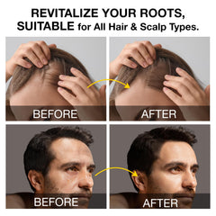 Beadlamey Root Activator Shampoo hands application for daily routine