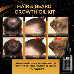 Beaueli minoxidil 5percent serum drops for daily scalp and beard use.