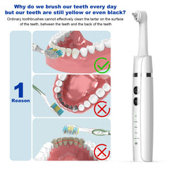 BEIERMU kit with six brush heads for targeted polishing