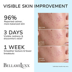 BellamiLuxx tea tree oil ingredient shot highlights natural antiseptic benefits.