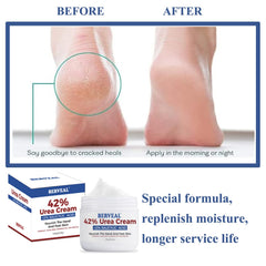 Applying BERVEAL Urea Cream on the foot for soft skin
