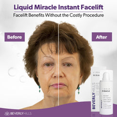 Beverly Hills Eye Serum applying under-eye area to reduce puffiness.