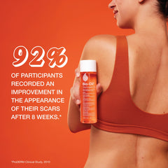 Bio-Oil application on hand demonstrates quick absorption without residue.