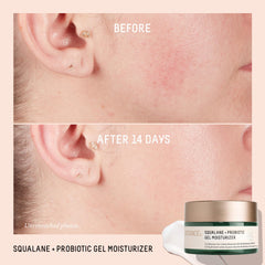 BIOSSANCE packaging label highlights encapsulated probiotics for a healthier skin microbiome.