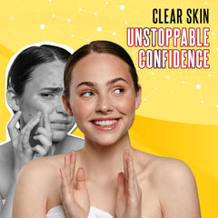 Biosulfur Grisi acne soap bar close-up highlighting sulfur-infused formula for cleansing.