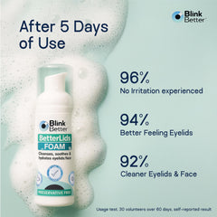 Daily eyelid hygiene routine using BetterLids cleanser.