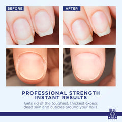 Blue Cross cuticle remover being applied for precise cuticle care.