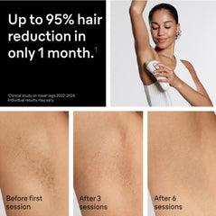 Precision heads enable targeted treatment on small areas with Braun Silk·Expert Pro 5