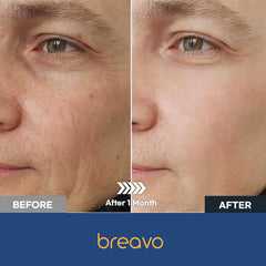 Breavo 6 in 1 Face Cream provides light hydration for a comfortable feel