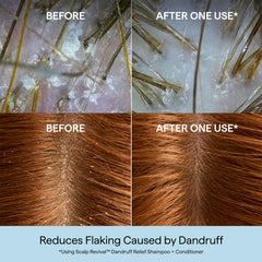Briogeo Scalp Revival closeup with charcoal for purification