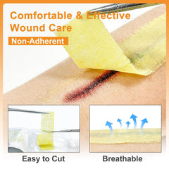 CARBOU Xeroform petrolatum gauze masks odor while keeping moisture.