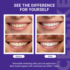CEELIKE hydroxyapatite strips close-up illustrating gentle stain lifting