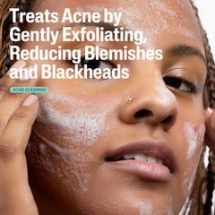 Pumped Cetaphil bottle close-up highlighting pore-friendly cleanse for sensitive skin.