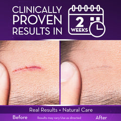 Cicatricure Advanced Scar Gel packaging with two tubes for home use.