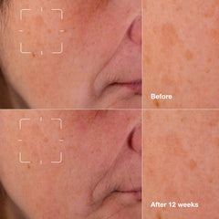 Clinique Even Better serum application on cheek demonstrates smooth, lightweight texture and quick absorption.