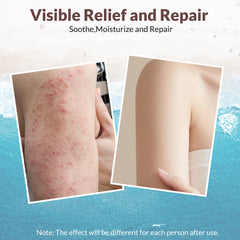 Crogooe aloe vera cooling effect image conveys instant relief