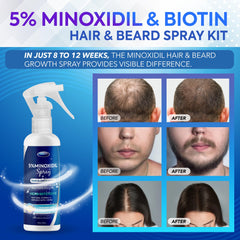 DABIDA minoxidil 5% formulation close-up highlights potent actives for growth.