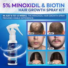 DABIDA Minoxidil spray-dispense ensures even coverage for scalp areas.