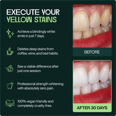 Dead Simple strips apply easily with secure adhesion for comfortable at-home whitening.