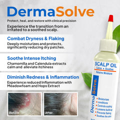 Dermasolve scalp oil being poured for quick absorption
