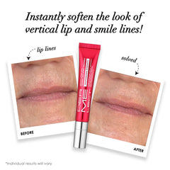 Dermelect applicator tip close-up enabling precise lip treatment and primer application
