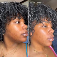 Dermisa Skin Fade Cream texture spread illustrates a non-greasy feel suitable for all skin types.