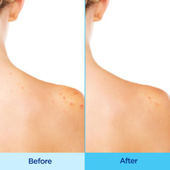 Back shoulder use with 360° spray for thorough coverage during workouts.