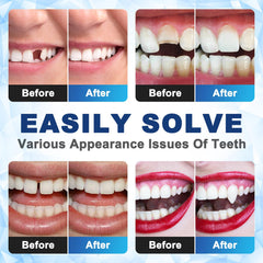 Soft material beads from DILLNALA that conform to tooth contours for comfort