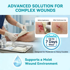 Dimora wound dressing maintains a moist environment on the wound