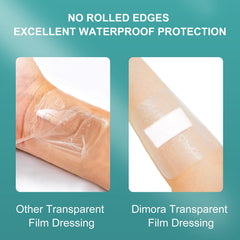 Dimora dressing applied to forearm demonstrates secure adhesion during daily movement.
