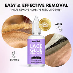 Dolahair Remove Wig Adhesive Lace Front image illustrates quick removal with minimal tugging.