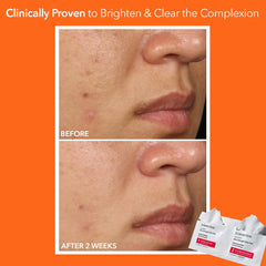 Dr Dennis Gross Alpha Beta Extra Strength Daily Peel close-up texture on skin after use