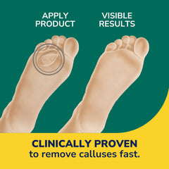 Discs on skin hint at immediate comfort from shoe pressure