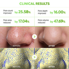 Close-up of pores before treatment with Dr.Melaxin CACTOX