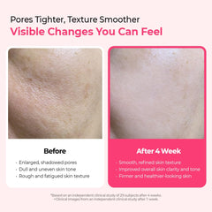 Dr.Melaxin Cyano Pink Spicule Serum with niacinamide supports barrier moisture