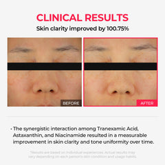 Dr.Melaxin TX Astaxanthin mask spread on the face showing even tone prep