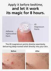 DWEasyDerm ampoule compact bottle for targeted spot calming.