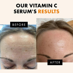 Eclat Skincare Vitamin C Serum texture melts into skin smoothly