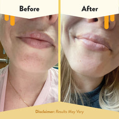 Eczema Honey Nourishing Lip Balm mango butter close-up highlighting rich moisture for very dry lips