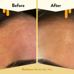 Key ingredients—honey, aloe, green tea—promoting comfort and gentle cleansing.
